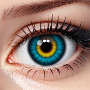 Can I wear contact lenses if I have a corneal abrasion?