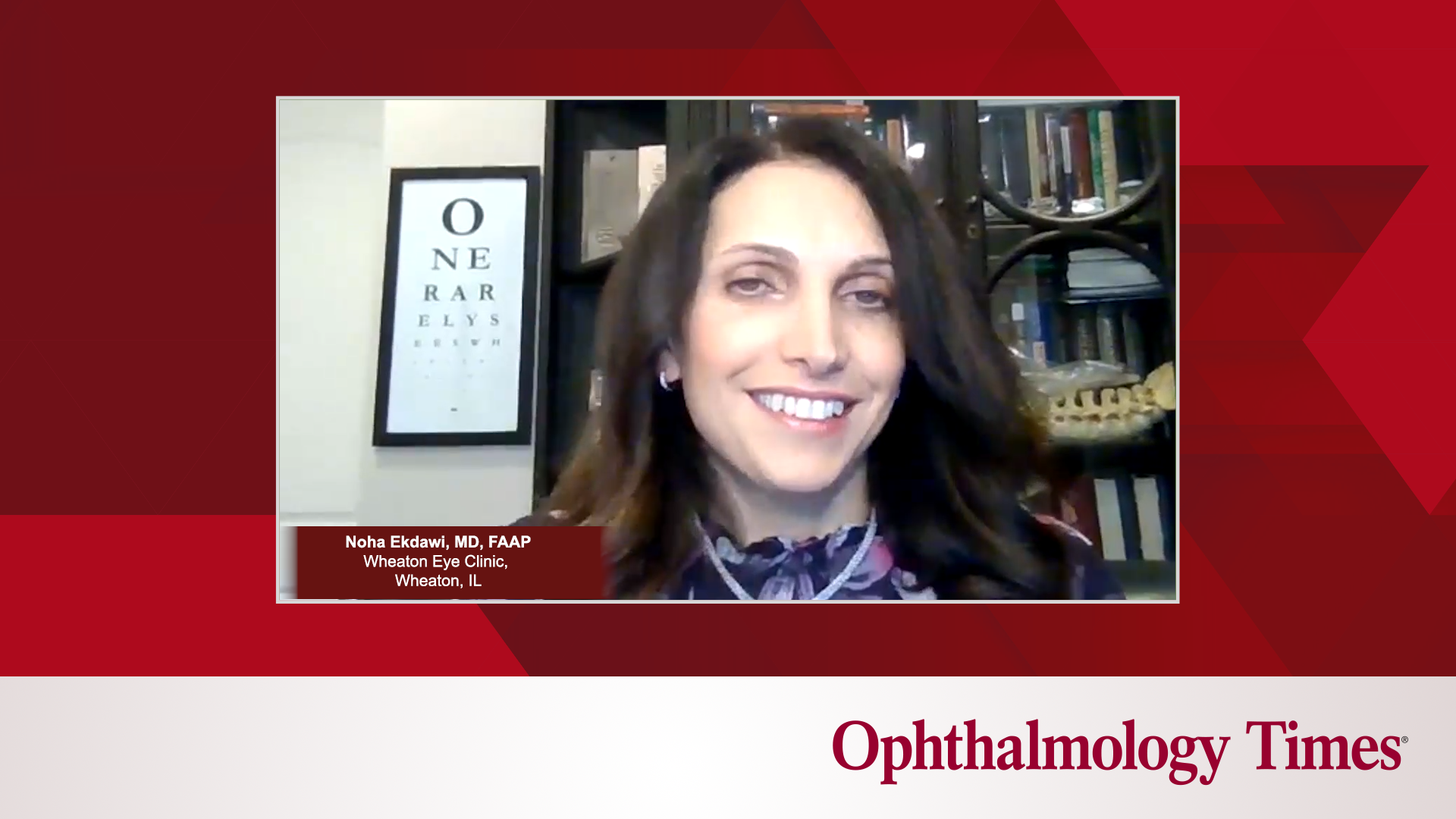 "Exploring The Benefits And Challenges Of Soft Contact Lenses For