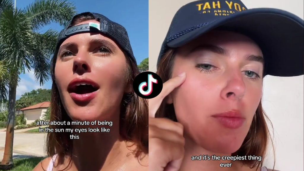"Viral TikTok Video Reveals Astonishing Eye Color Transformation With